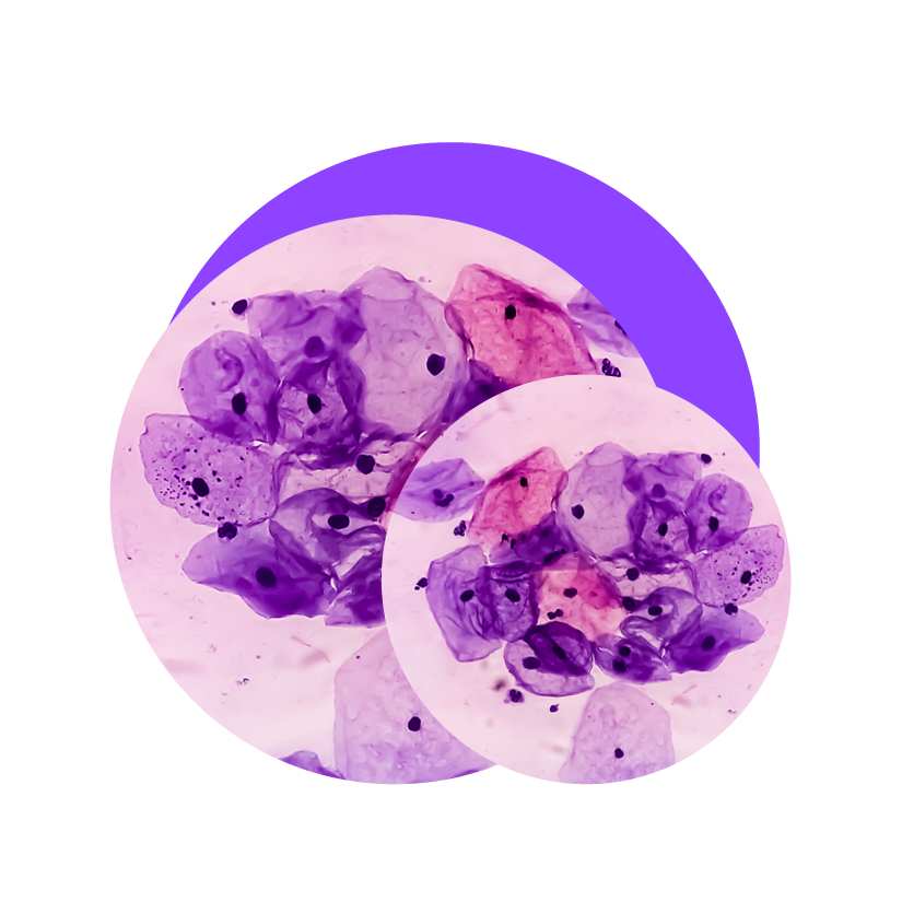 Abstract scientific visual representing the virus like particle technology behind the HPV cervical cancer vaccine, alongside text 'from virus to prevention', with a purple background.
