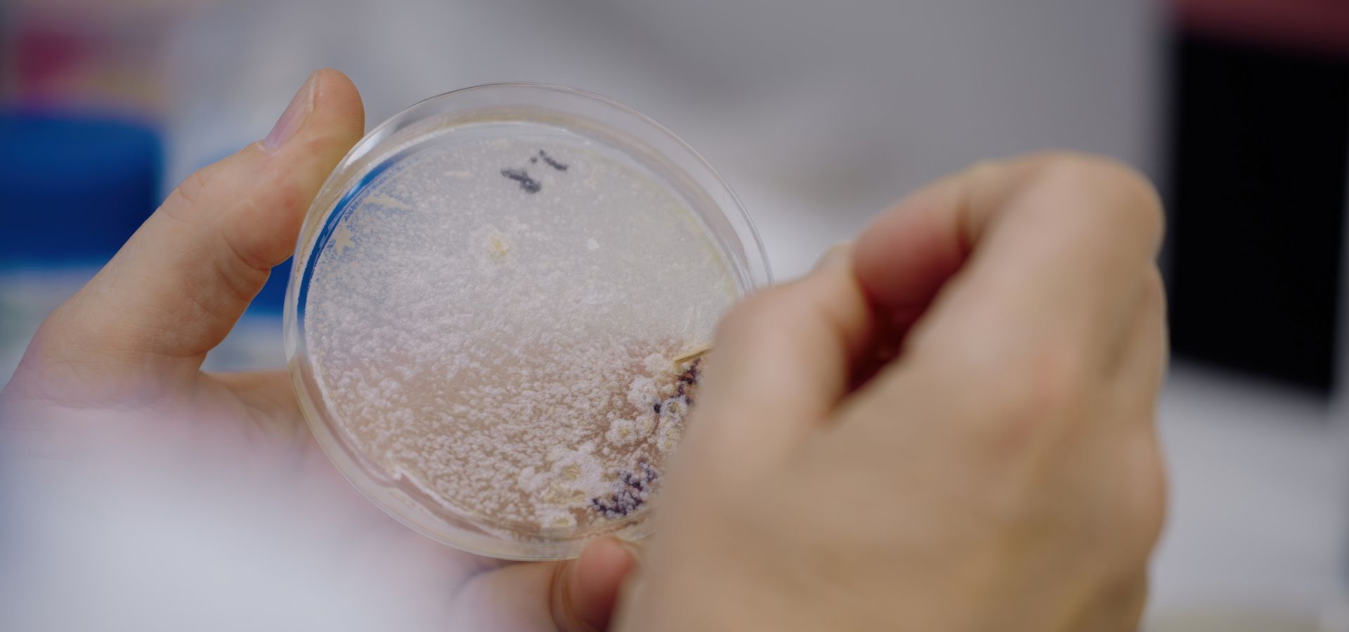 Lab test